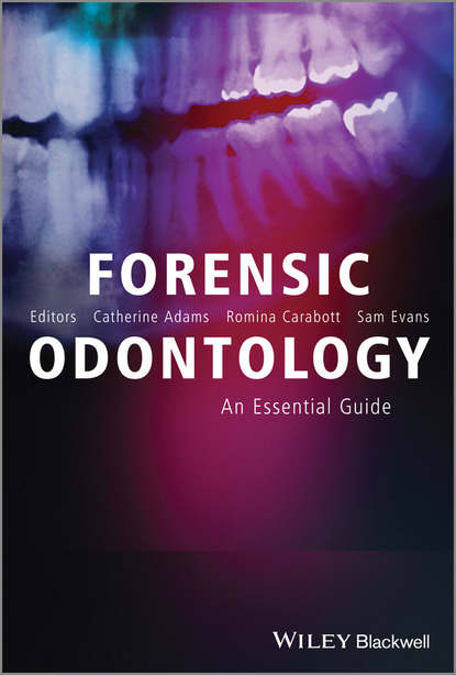 Forensic Odontology