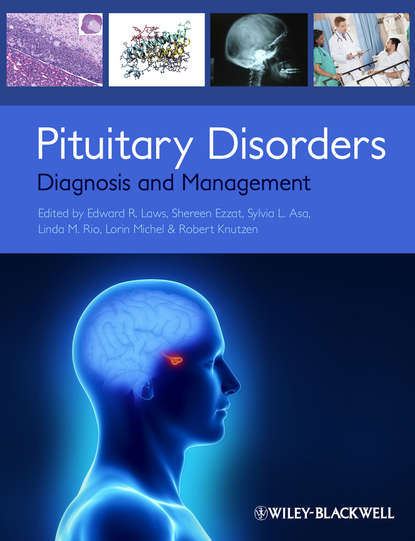 эндокринология  ЛитРес Pituitary Disorders