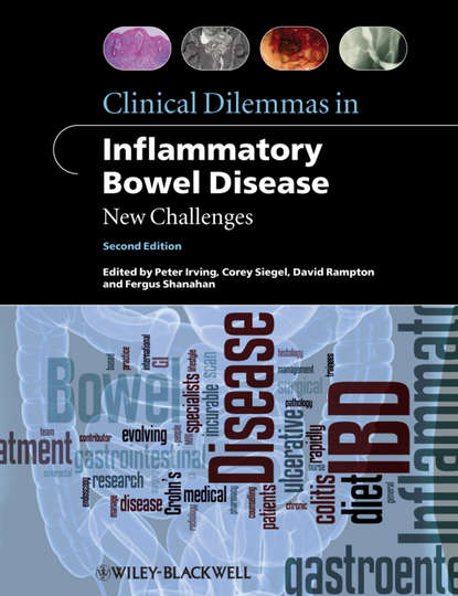 гастроэнтерология Clinical Dilemmas in Inflammatory Bowel Disease