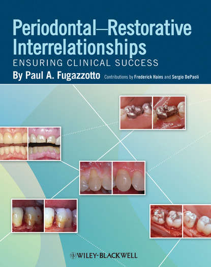 стоматология Periodontal-Restorative Interrelationships