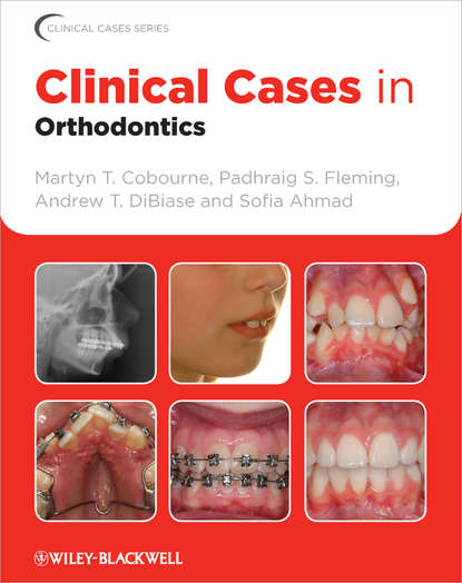 стоматология  ЛитРес Clinical Cases in Orthodontics