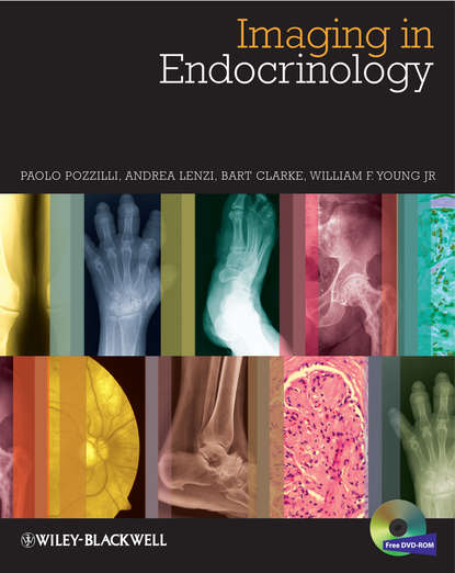 эндокринология Imaging in Endocrinology