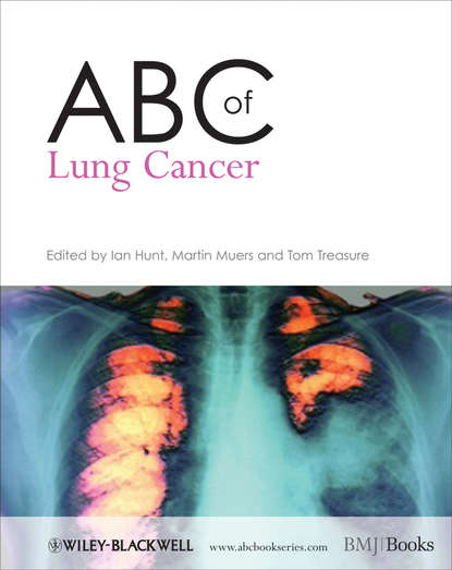 ABC of Lung Cancer