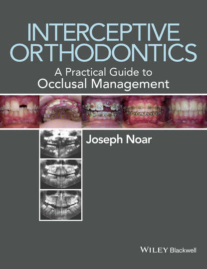 стоматология  ЛитРес Interceptive Orthodontics