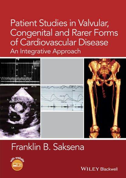 Patient Studies in Valvular, Congenital, and Rarer Forms of Cardiovascular Disease