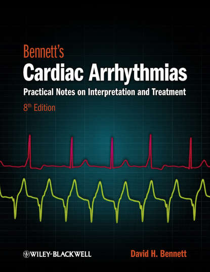 Bennett's Cardiac Arrhythmias