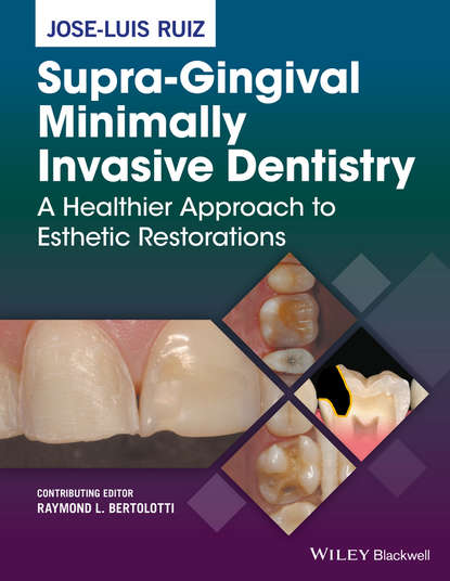 стоматология  ЛитРес Supra-Gingival Minimally Invasive Dentistry