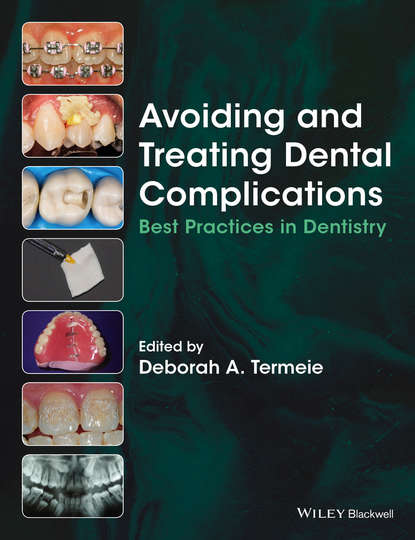 стоматология Avoiding and Treating Dental Complications