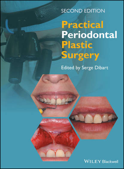 стоматология Practical Periodontal Plastic Surgery