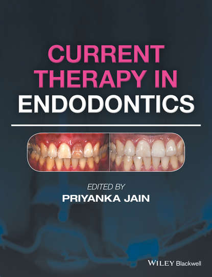 стоматология Current Therapy in Endodontics