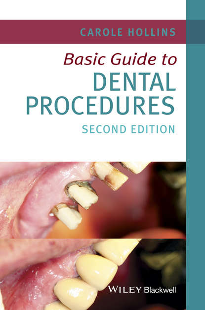 стоматология Basic Guide to Dental Procedures