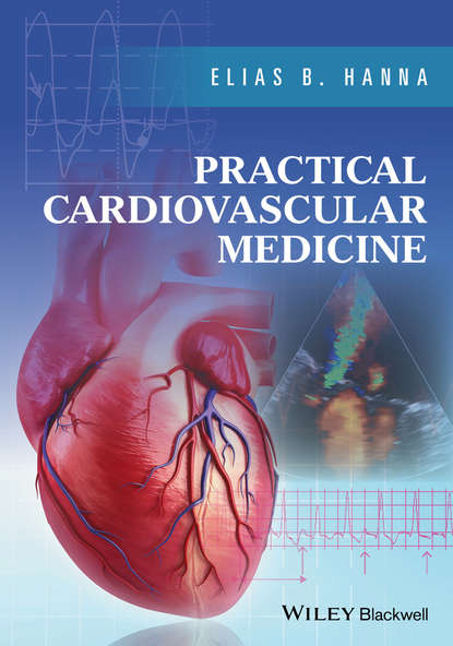 кардиология  ЛитРес Practical Cardiovascular Medicine