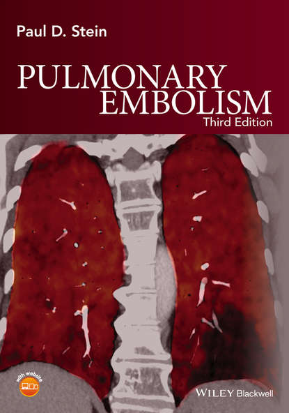 кардиология  ЛитРес Pulmonary Embolism