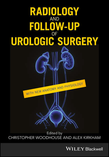 урология и нефрология  ЛитРес Radiology and Follow-up of Urologic Surgery