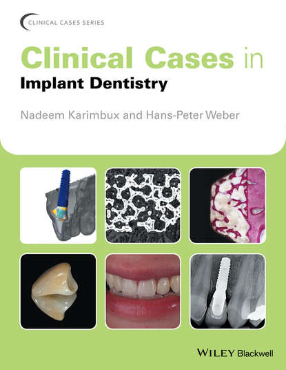 Clinical Cases in Implant Dentistry