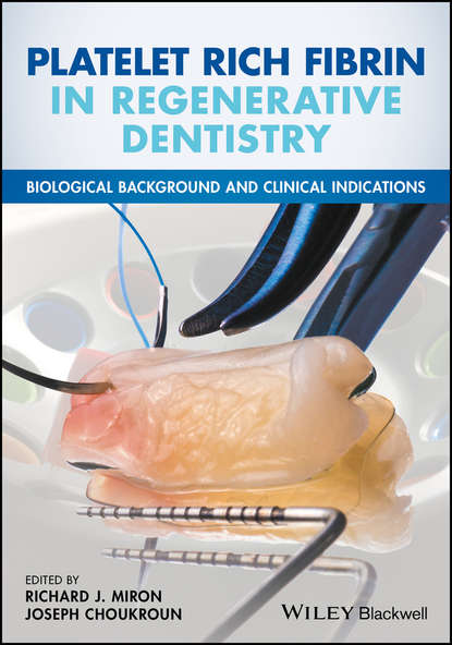 стоматология Platelet Rich Fibrin in Regenerative Dentistry