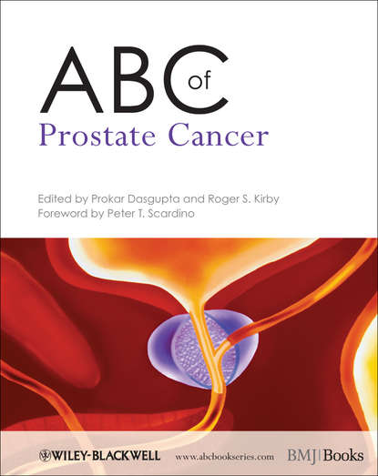 урология и нефрология  ЛитРес ABC of Prostate Cancer