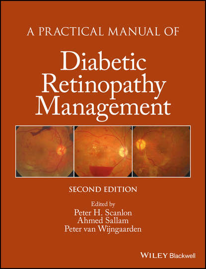 эндокринология A Practical Manual of Diabetic Retinopathy Management