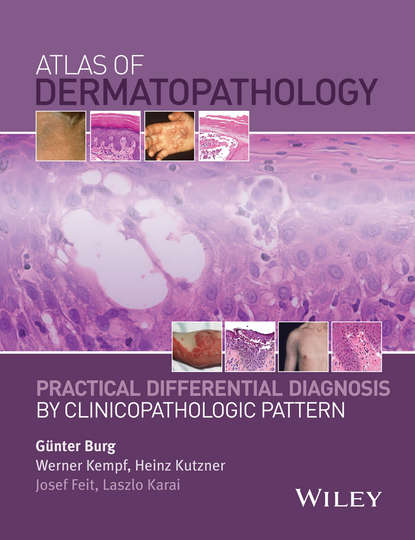 дерматология Atlas of Dermatopathology