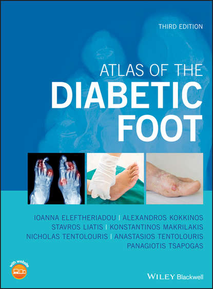 Atlas of the Diabetic Foot