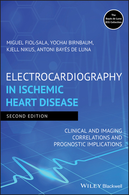 кардиология Electrocardiography in Ischemic Heart Disease