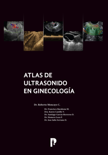 Atlas de ultrasonido en ginecolog?a