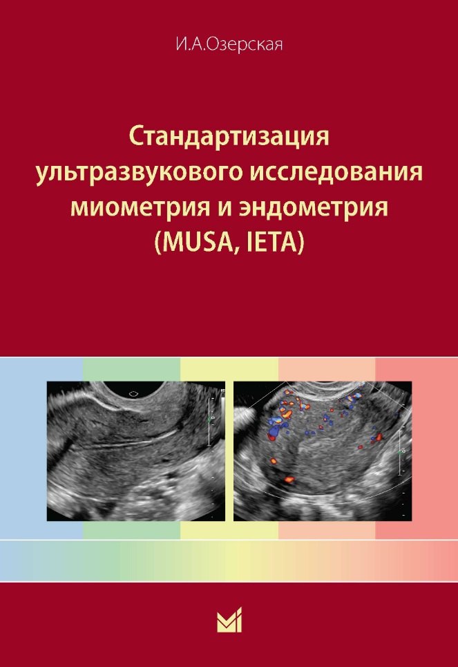 Стандартизация ультразвукового исследования миометрия и эндометрия (MUSA, IETA)