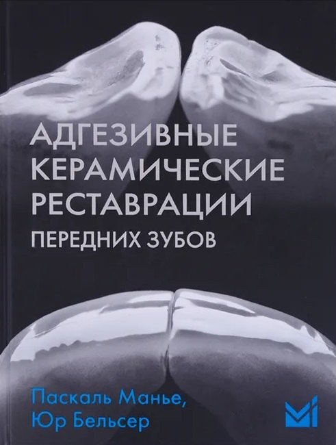 Адгезивные керамические реставрации передних зубов