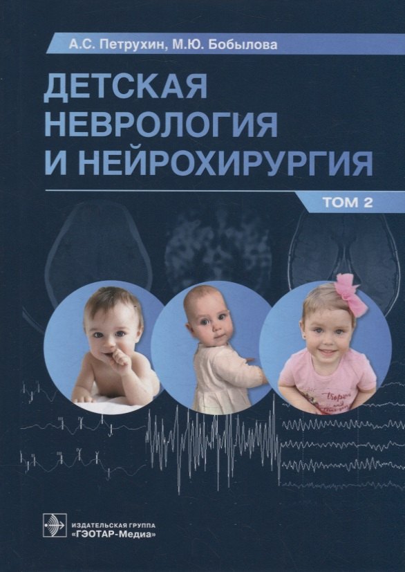  Детская неврология и нейрохирургия: учебник: в 2-х томах. Том 2