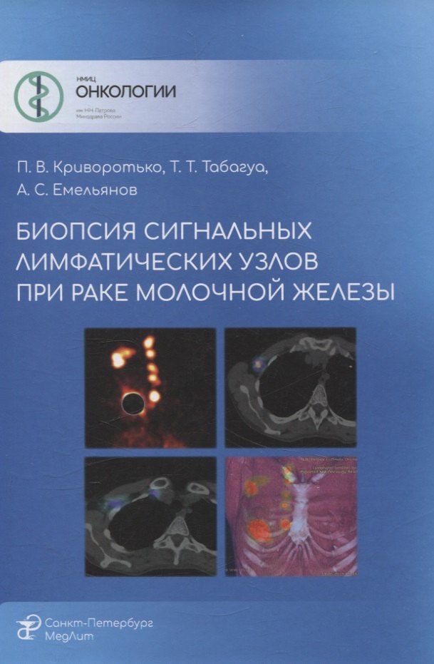   Читай-город Биопсия сигнальных лимфатических узлов при раке молочной железы