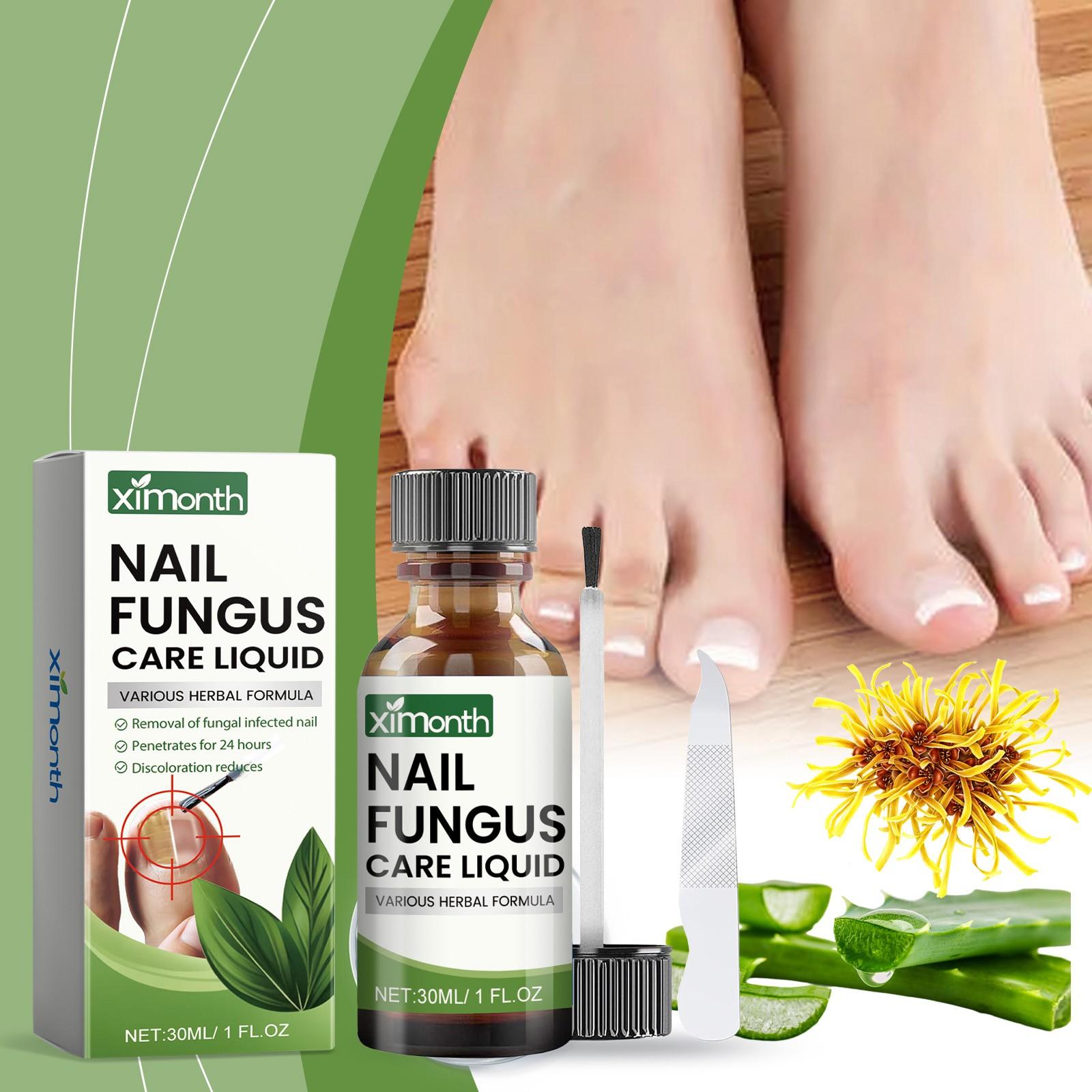 Лечение грибка ногтей на ногах Extra Strong, NailTreatment, Средство по уходу за ногтями Extra Strong для толстых, обесцвеченных и поврежденных ногтей, 30 мл белый