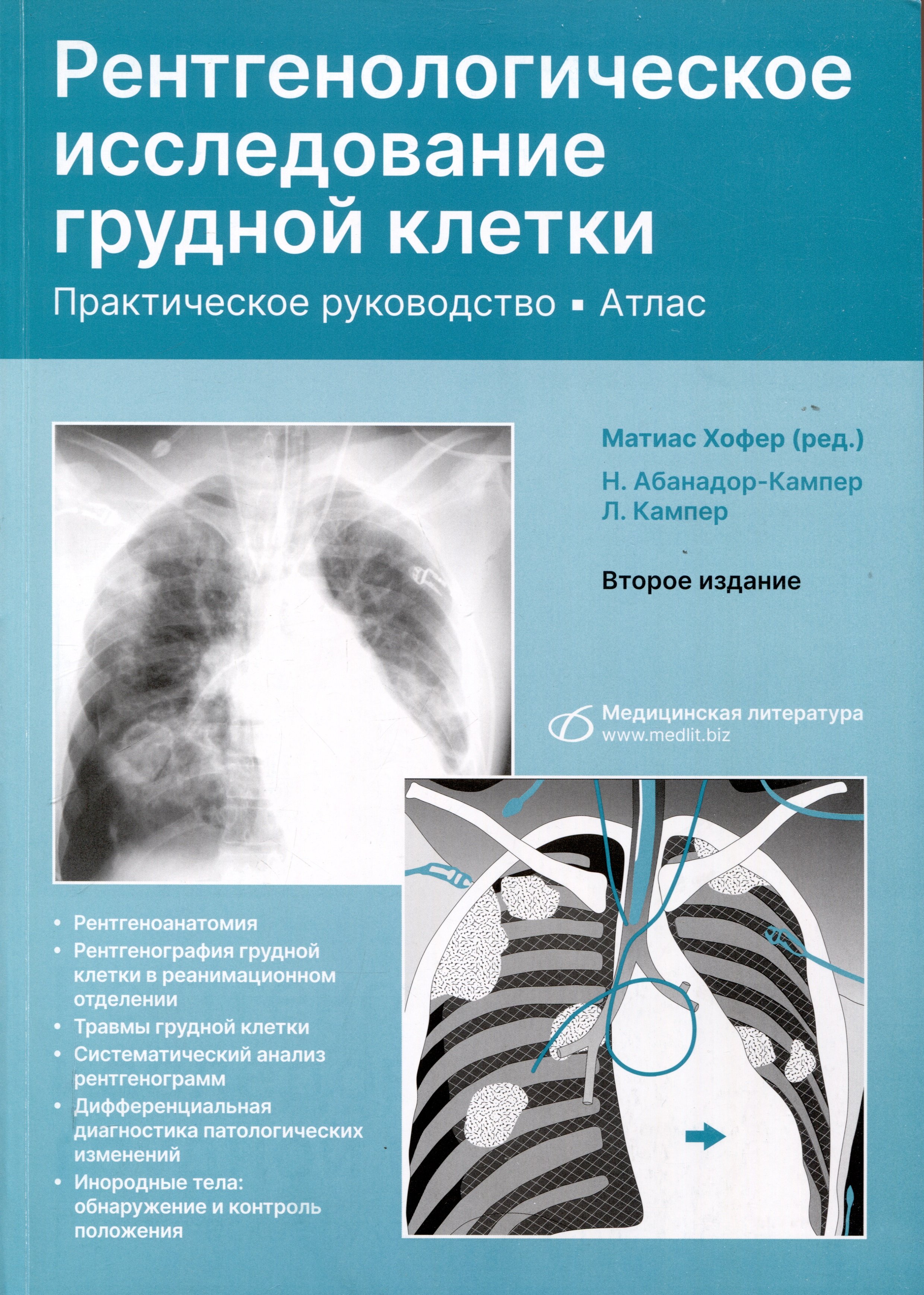 Рентгенологическое исследование грудной клетки. Практическое руководство. Атлас